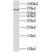 WB analysis of mouse brain tissue, using TMX3 antibody (1/300 dilution).