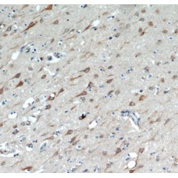Thioredoxin Related Transmembrane Protein 4 (TMX4) Antibody