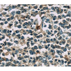 Tumor Necrosis Factor, Alpha-Induced Protein 8 (TNFAIP8) Antibody