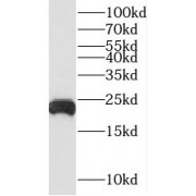 WB analysis of A549 cells, using TNFAIP8 antibody (1/300 dilution).