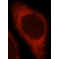 Tumor Necrosis Factor Receptor 2 (TNFR2) Antibody