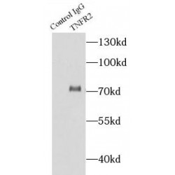 Tumor Necrosis Factor Receptor 2 (TNFR2) Antibody