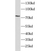 WB analysis of Jurkat cells, using TNFR2 antibody (1/500 dilution).