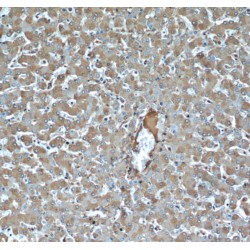 TNFAIP3-Interacting Protein 2 (TNIP2) Antibody