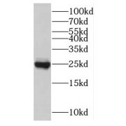 WB analysis of mouse skeletal muscle tissue, using TNNI1 antibody (1/1000 dilution).