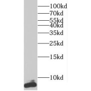 WB analysis of mouse testis tissue, using TNP1 antibody (1/1000 dilution).