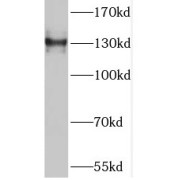 WB analysis of mouse kidney tissue, using TNS3 antibody (1/100 dilution).
