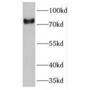 WB analysis of human placenta tissue, using TNS4 antibody (1/800 dilution).