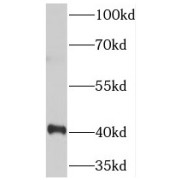WB analysis of HeLa cells, using TOB1 antibody (1/1000 dilution).