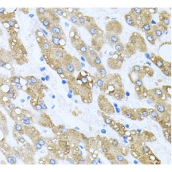 Protein Tob2 (TOB2) Antibody