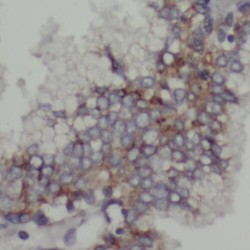 TOM1-Like Protein 1 (TOM1L1) Antibody
