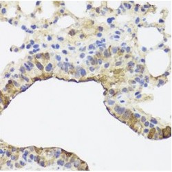 Mitochondrial Import Receptor Subunit TOM34 (TOMM34) Antibody