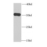 WB analysis of PC-3 cells, using TOMM34 antibody (1/1000 dilution).
