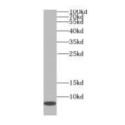 WB analysis of Raji cells.