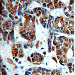 Topoisomerase (DNA) II Beta (TOP2B) Antibody