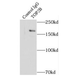 Topoisomerase (DNA) II Beta (TOP2B) Antibody