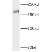 WB analysis of HeLa cells, using TOP2B antibody (1/300 dilution).
