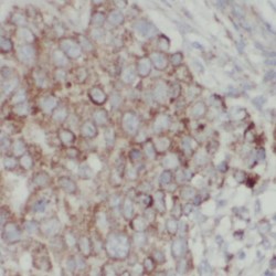 Tumor Protein D54 (TPD52L2) Antibody