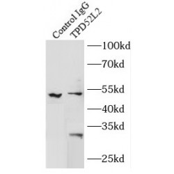 Tumor Protein D54 (TPD52L2) Antibody