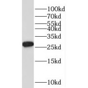 WB analysis of HEK-293 cells, using TPD52L2 antibody (1/800 dilution).