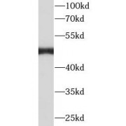 WB analysis of HL60 cells, using TPH1 antibody (1/1000 dilution).