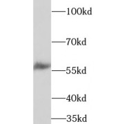 WB analysis of Rat brain, using TPH2 antibody (1/1000 dilution).