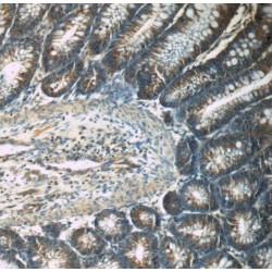 Tropomyosin Alpha-3 Chain (TPM3) Antibody