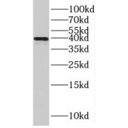 WB analysis of mouse skeletal muscle tissue, using TPM3 antibody (1/600 dilution).