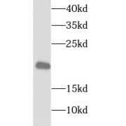 WB analysis of human kidney tissue, using TPPP3 antibody (1/1000 dilution).