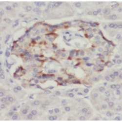 Protein-Tyrosine Sulfotransferase 2 (TPST2) Antibody