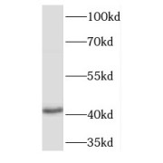 WB analysis of human liver tissue, using TPST2 antibody (1/500 dilution).