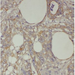 Translationally-Controlled Tumor Protein (TPT1) Antibody