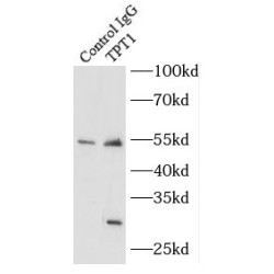 Translationally-Controlled Tumor Protein (TPT1) Antibody