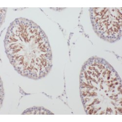 Putative Tyrosine-Protein Phosphatase TPTE (TPTE) Antibody