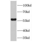 WB analysis of L02 cells, using TPTE2 antibody (1/300 dilution).