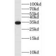 WB analysis of A549 cells, using TRA2A antibody (1/3000 dilution).