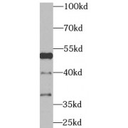 WB analysis of MCF-7 cells, using TRAF4 antibody (1/1000 dilution).