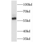 WB analysis of A431 cells, using TRAF6 antibody (1/300 dilution).