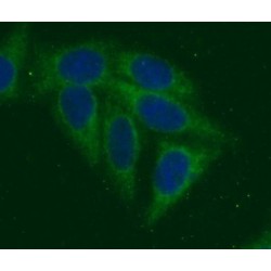 E3 Ubiquitin-Protein Ligase TRAIP (TRAIP) Antibody