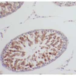 E3 Ubiquitin-Protein Ligase TRAIP (TRAIP) Antibody