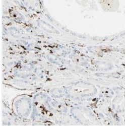 Translocating Chain-Associated Membrane Protein 1 (TRAM1) Antibody