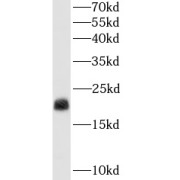 WB analysis of human colon tissue, using TAGLN antibody (1/4000 dilution).