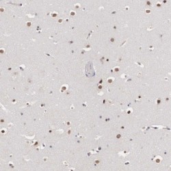 Trans-Activation-Responsive RNA-Binding Protein (TRBP) Antibody