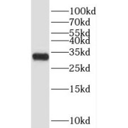 WB analysis of Transfected HEK-293 cells, using TRIAP1 antibody (1/1000 dilution).