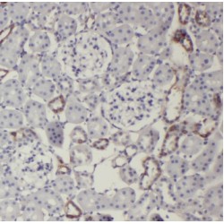 Tripartite Motif-Containing Protein 2 (TRIM2) Antibody