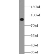 WB analysis of mouse small intestine tissue, using TRIM2 antibody (1/500 dilution).