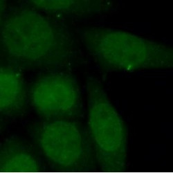 Zinc Finger Protein RFP (TRIM27) Antibody