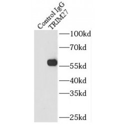 Zinc Finger Protein RFP (TRIM27) Antibody