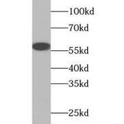 WB analysis of Jurkat cells, using TRIM27 antibody (1/1000 dilution).
