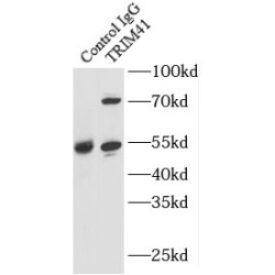 E3 Ubiquitin-Protein Ligase TRIM41 (TRIM41) Antibody